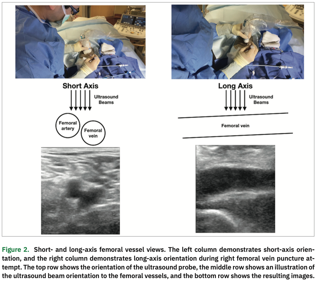 Integrating LongAxis and ShortAxis Views with a Twist for Ultrasound
